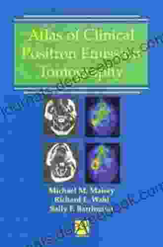 Atlas Of Clinical Positron Emission Tomography